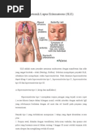 Download Sistemik Lupus Eritematosus by sri wahyuni SN9070621 doc pdf