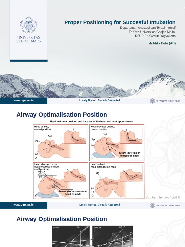 PR Ati Position Intubation | PDF