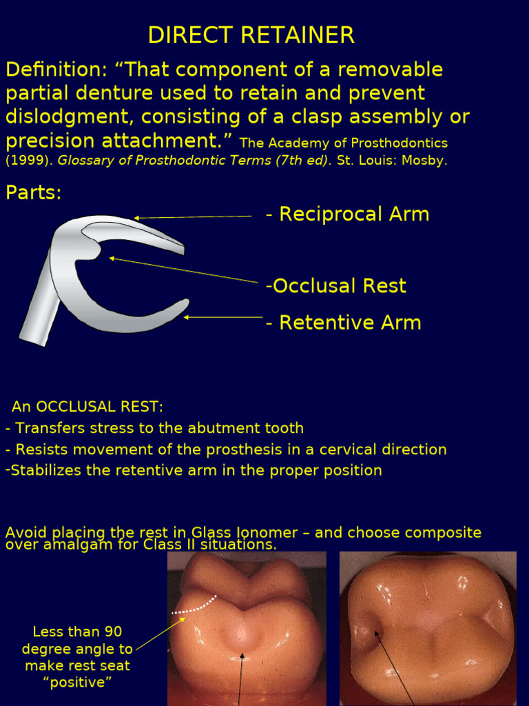 Direct Retainer: Glossary of Prosthodontic Terms (7th Ed) | PDF ...