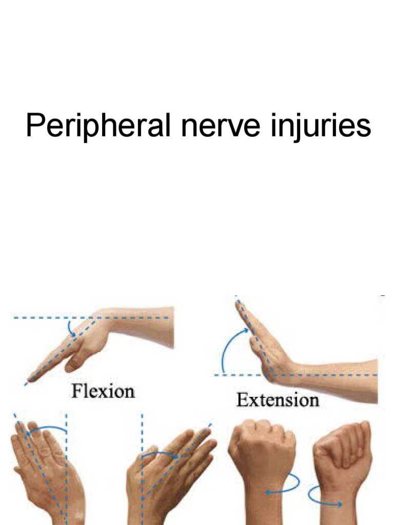 Understanding Peripheral Nerve Injuries | PDF | Elbow | Thumb