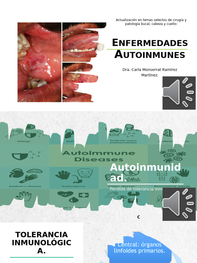 Enfermedades Autoinmunes Ula | PDF | Sistema inmune | Enfermedad autoinmune