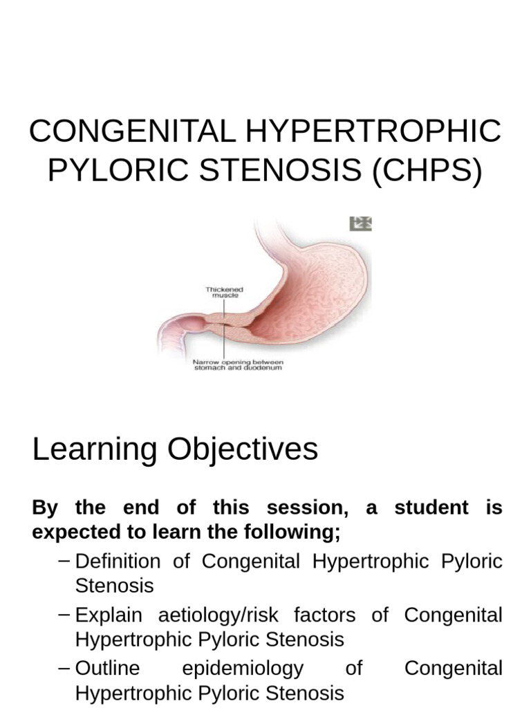 Congenital Hypertrophic Pyloric Stenosis Guide | PDF | Medical ...