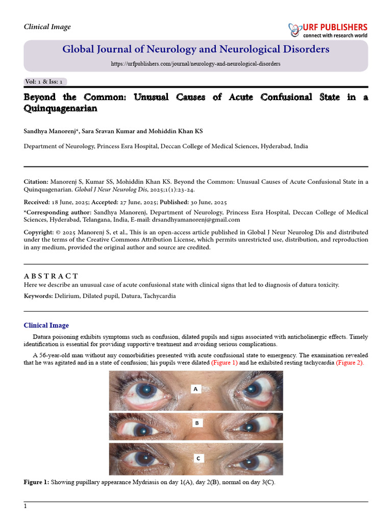 Beyond The Common: Unusual Causes of Acute Confusional State in A ...