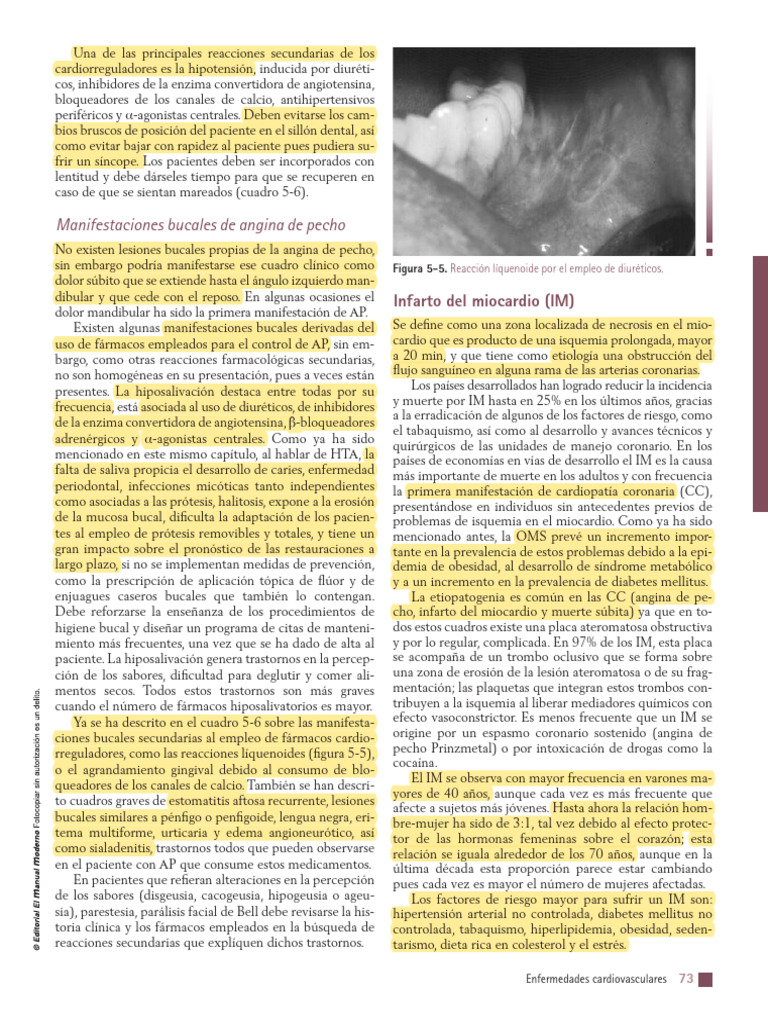 7.2. Infarto de Miocardio | PDF | Infarto de miocardio | Enfermedades y ...