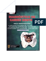 Henostroza - Diagnostico de Caries Dental