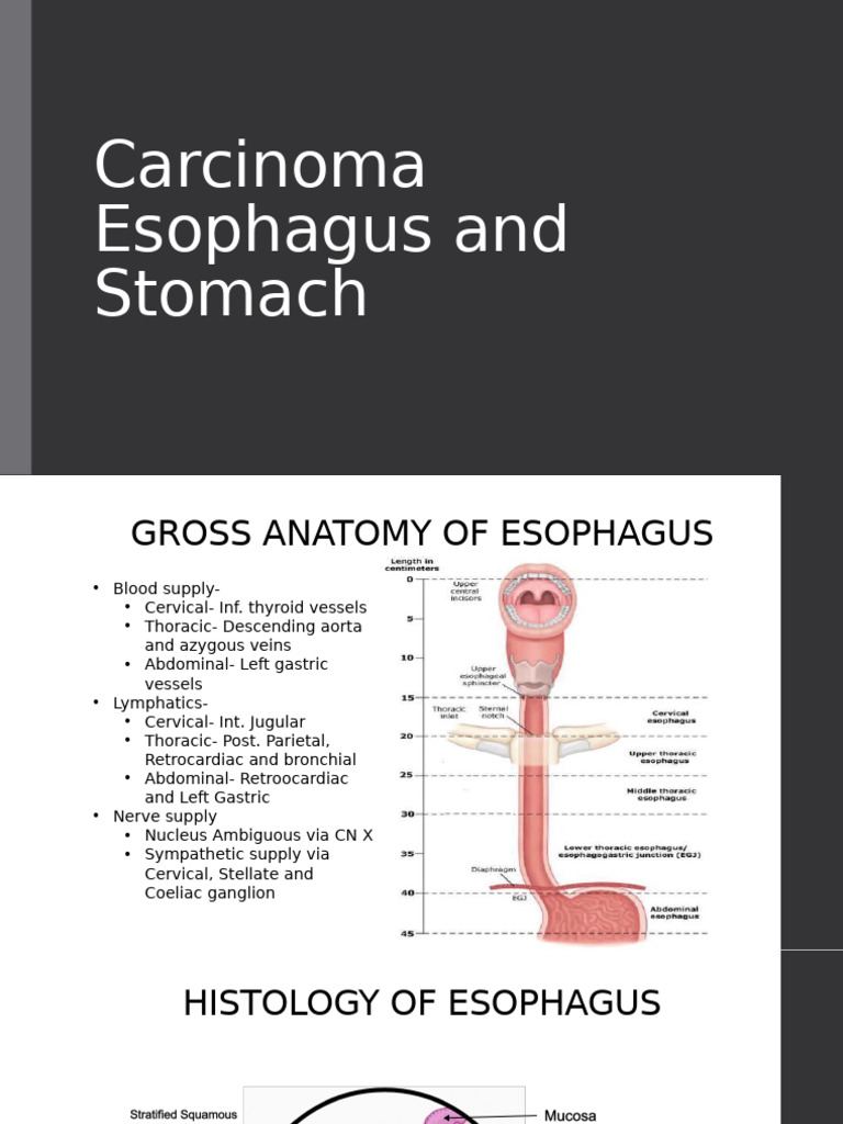 Carcinoma Esophagus and Stomach | PDF | Esophagus | Stomach