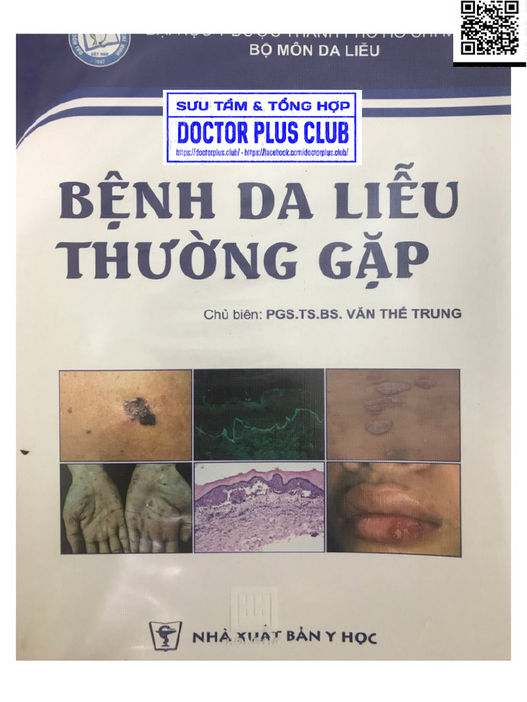 Bệnh Da Liễu Thường Gặp | PDF