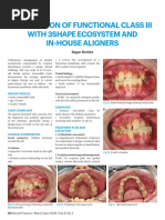 3° Midline Deviation Treatment Mechanics | PDF | Orthodontics ...