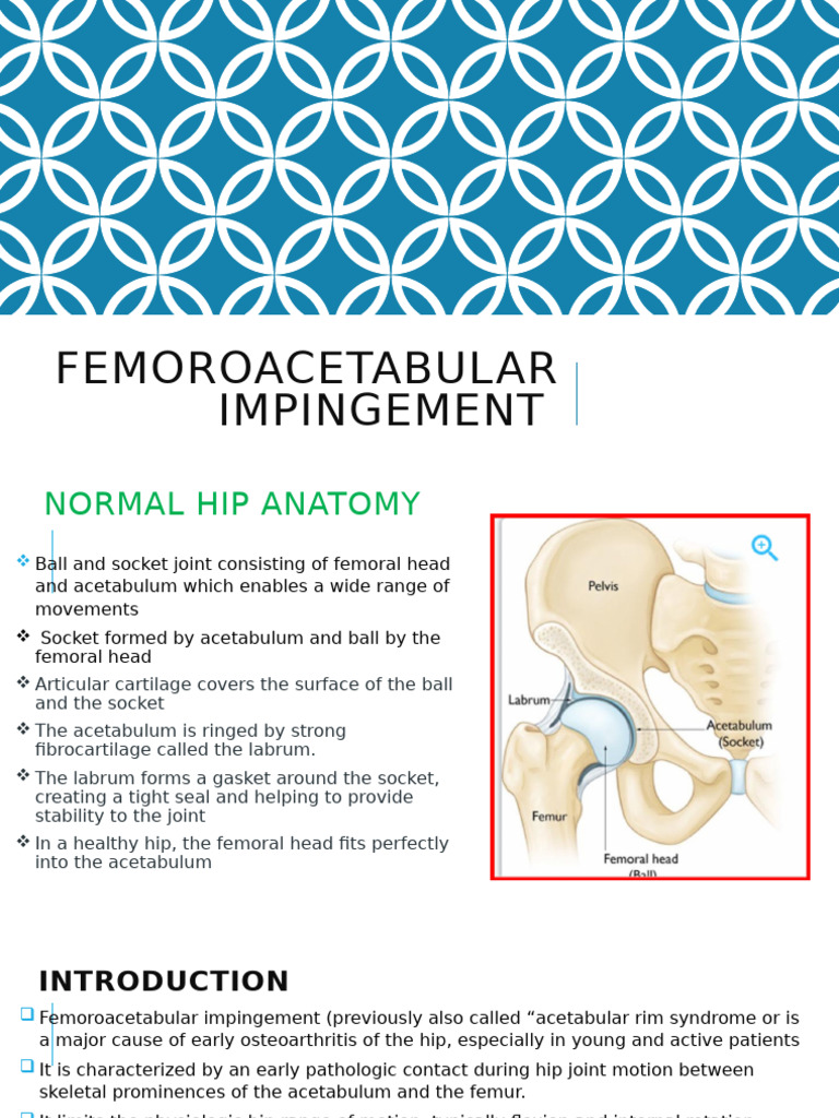 Femoroacetabular Impingement | PDF | Hip | Pelvis
