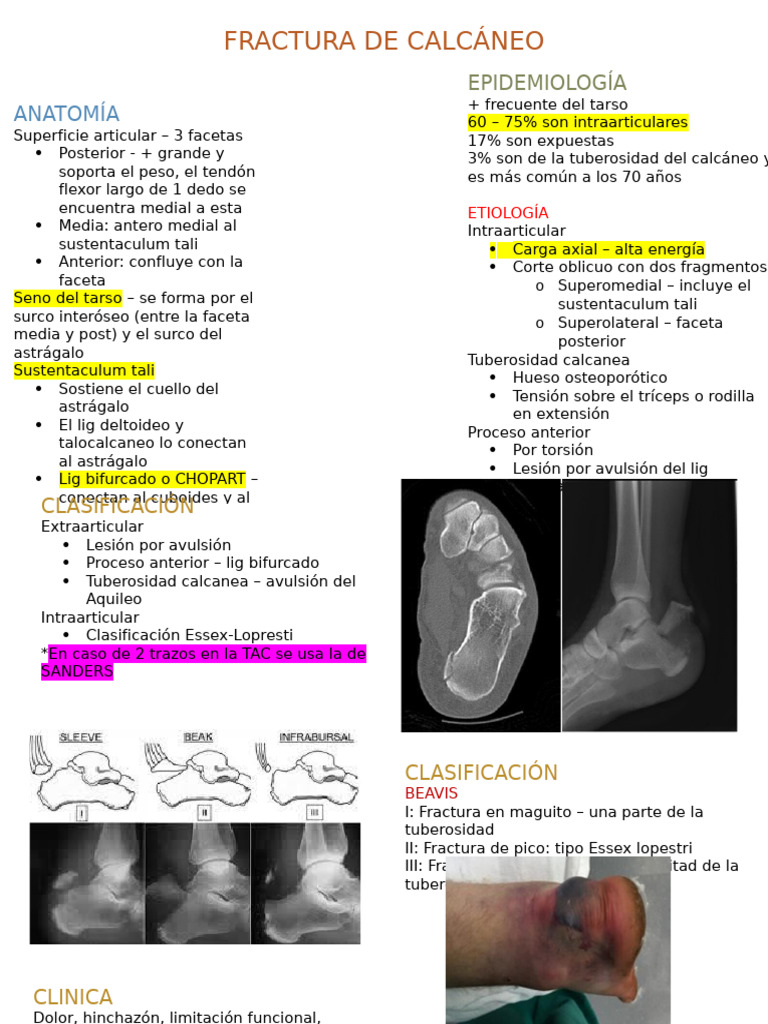 Fractura de Calcáneo: Clasificación y Tratamiento | PDF | Anatomía del ...