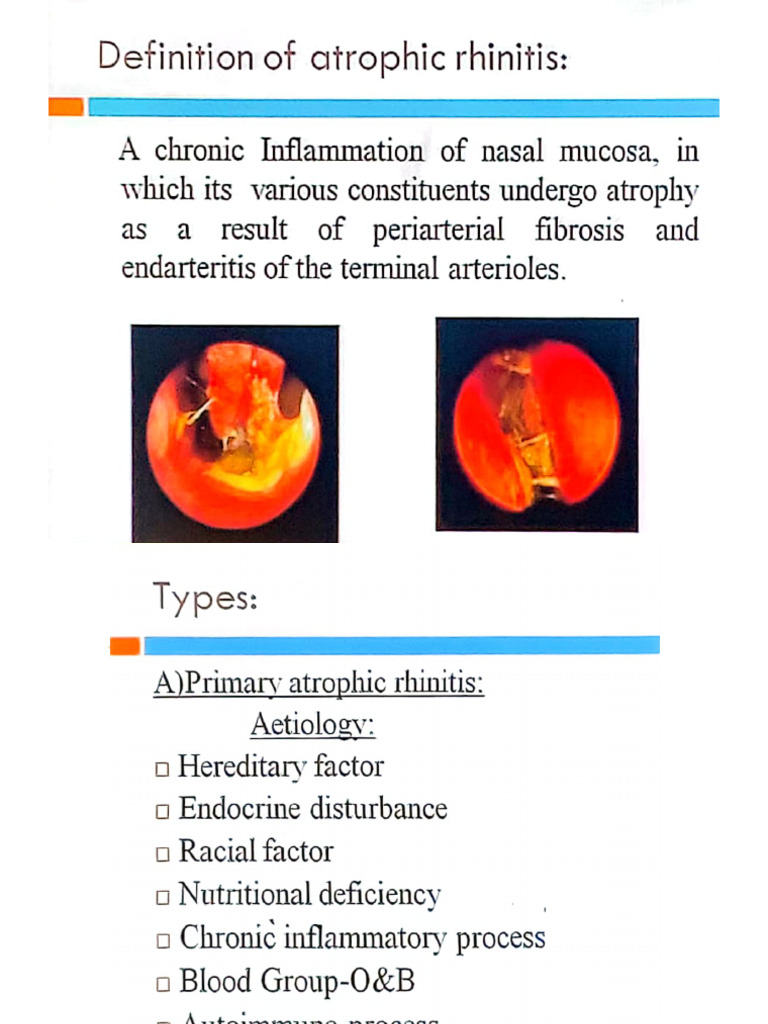 Rhinitis | PDF
