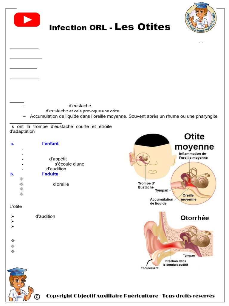 Évaluation des Otites et Traitements | PDF