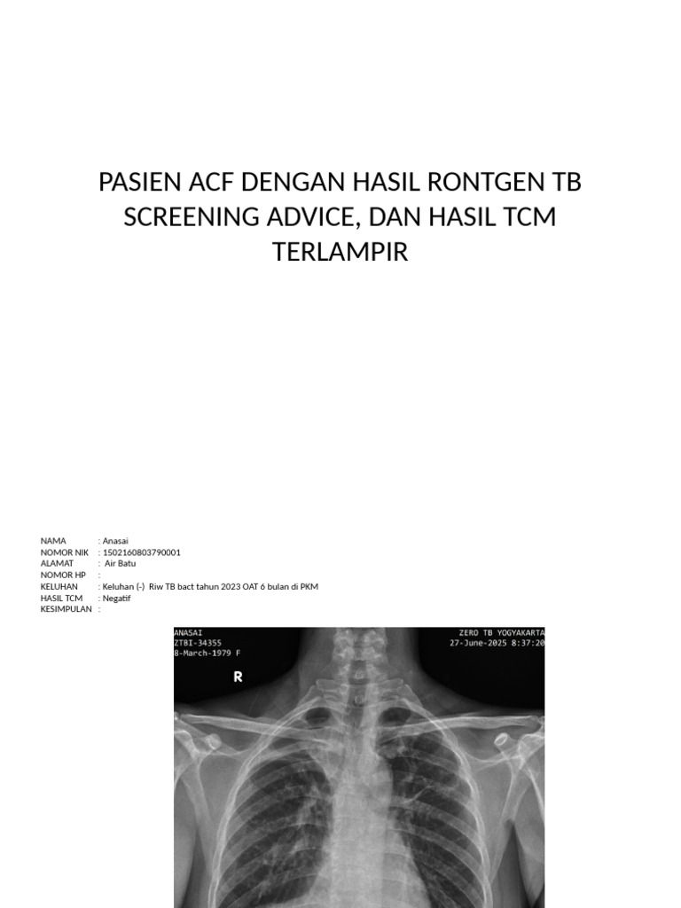 Hasil Rontgen dan TCM Pasien TB | PDF