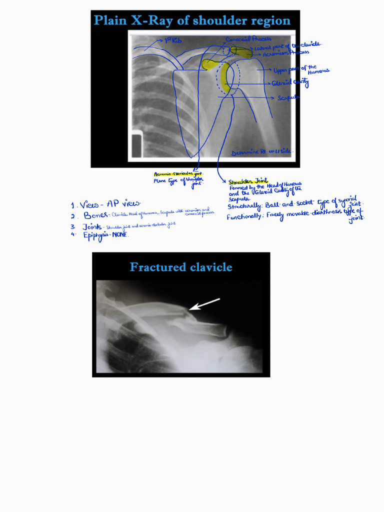 Radiology 250202 172016 | PDF