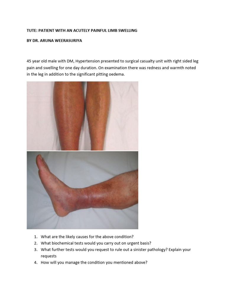 Acute Limb Swelling: Diagnosis & Management | PDF