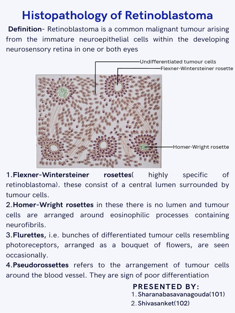 Retinoblastoma Histopathology Insights | PDF