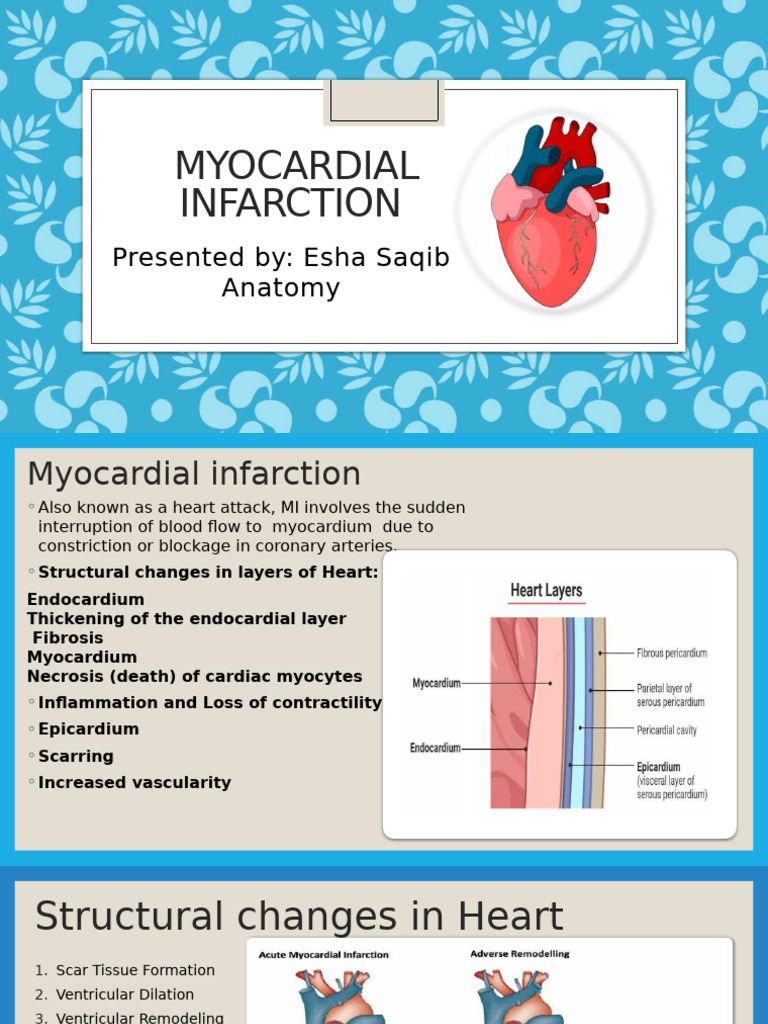 Myocardial Infarction | PDF