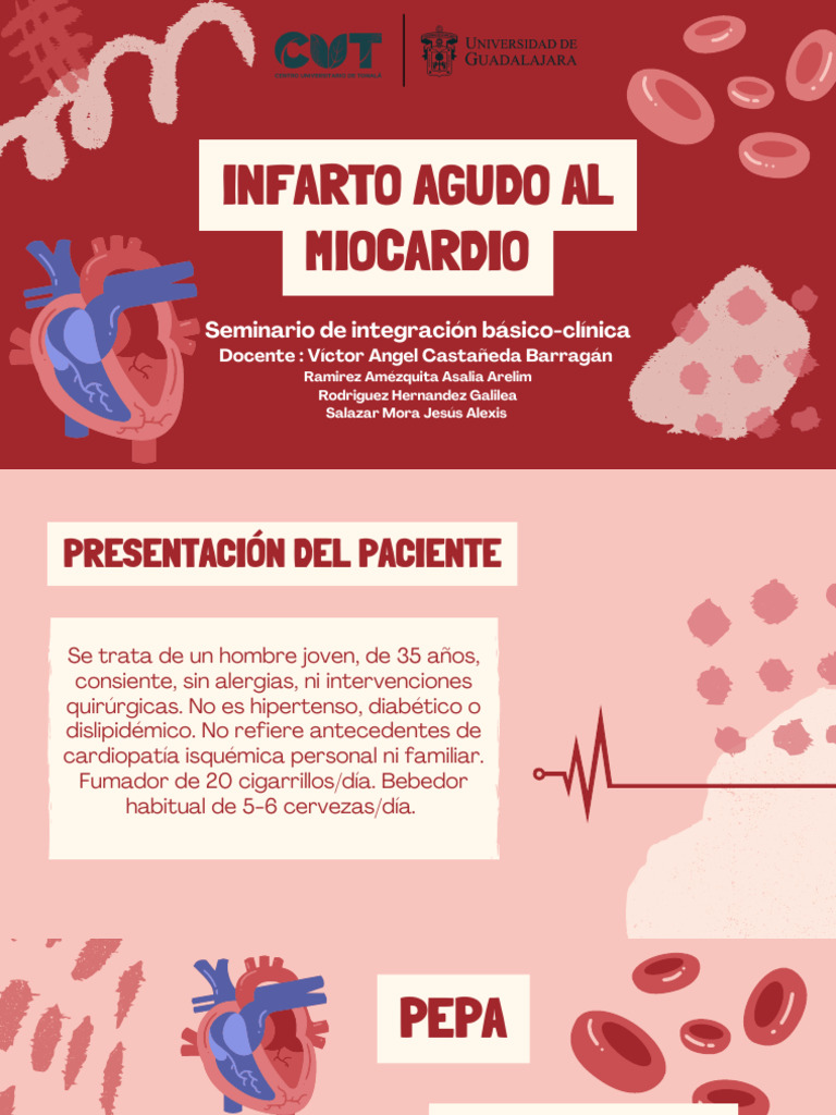 Infarto Agudo Al Miocardio | PDF | Infarto de miocardio | Reanimación ...