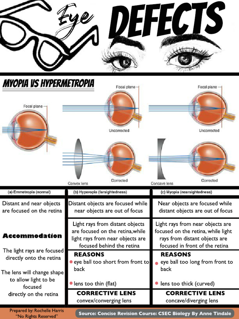 Myopia vs Hypermetropia Explained | PDF