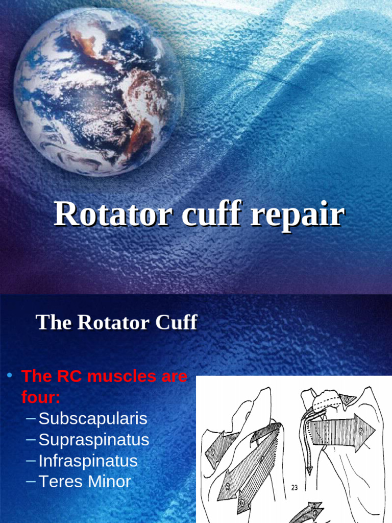 Rotator Cuff Repair: Surgical Guide | PDF | Anatomical Terms Of Motion ...