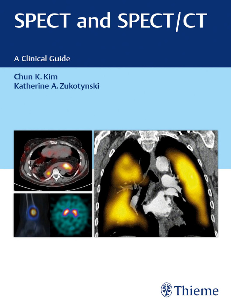 SPECT and SPECT/CT Clinical Guide | PDF | X Ray | Radiography