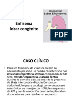 ENFISEMA LOBAR CONGÉNITO