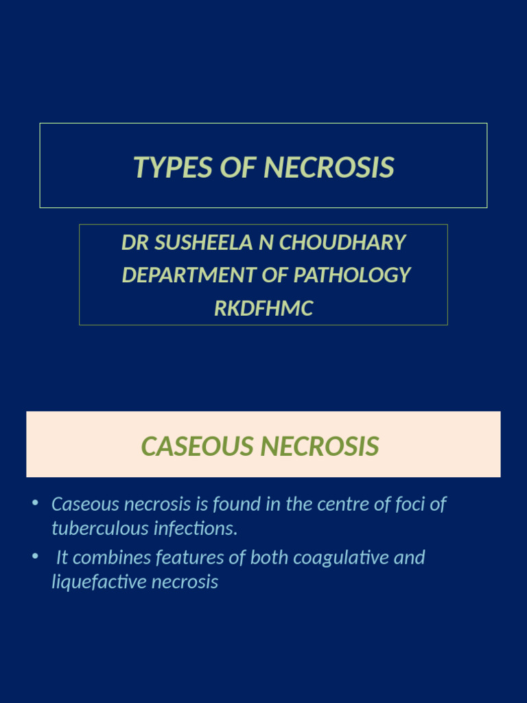 Understanding Caseous Necrosis in Tuberculosis | PDF