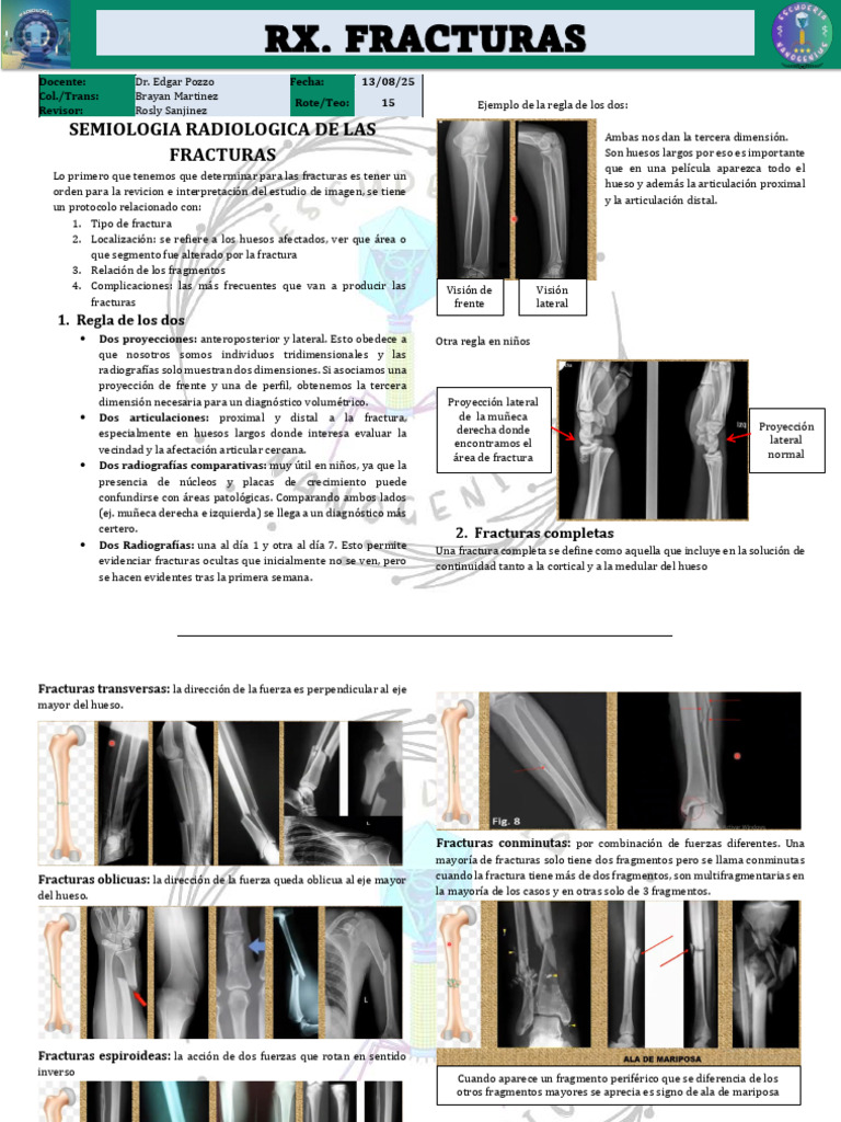 Med1-R4-Rx-T15-Rx Fracturas | PDF | Hueso | Rodilla