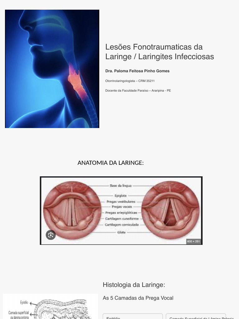 Lesões Laríngeas e Laringites Infecciosas | PDF | Laringe | Câncer