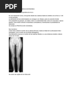 Eficiencia del Método Merchant en Rótula | PDF | Rodilla | Imagenes medicas