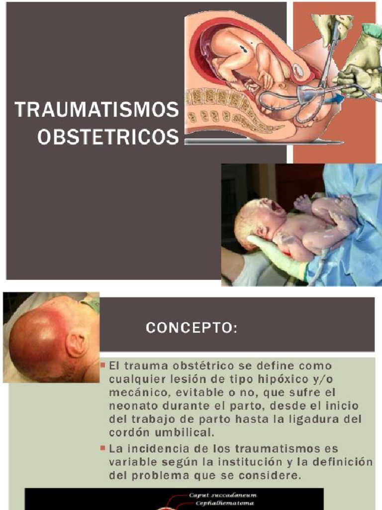 Traumas Obstetricos NEO 2021 | PDF