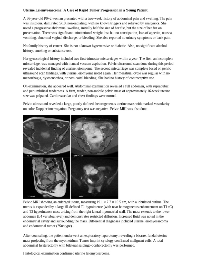 Rapid Progression of Uterine Leiomyosarcoma | PDF | Uterus | Miscarriage
