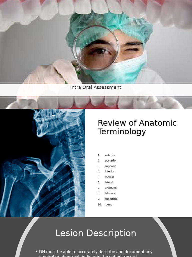 Intraoral Exam and Cancer Risk Factors | PDF | Tongue | Mouth
