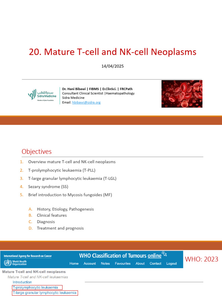 20. Mature T and NK-cell Neoplasms-April 2025 | PDF | Leukemia | T Cell