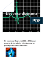 Electrocardiogram A