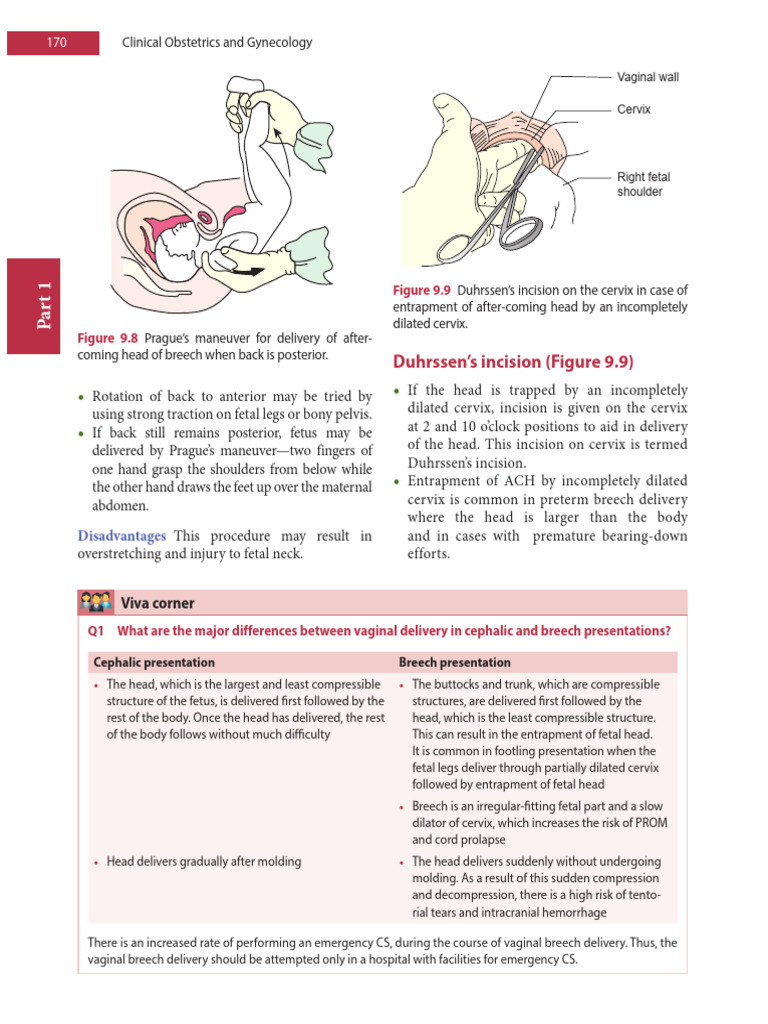 Duhrssen's Incision in Breech Delivery | PDF | Childbirth | Human ...