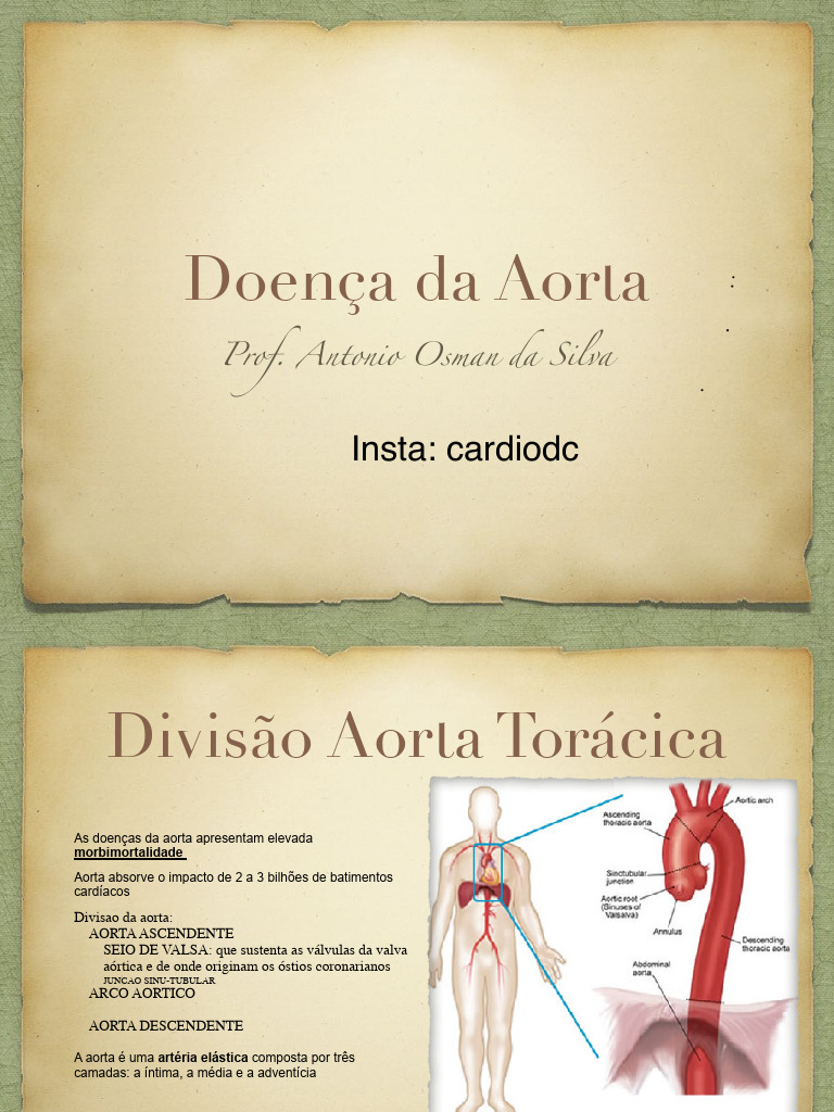 Doenças da Aorta: Aneurismas e Dissecções | PDF | Coração | Fisiologia