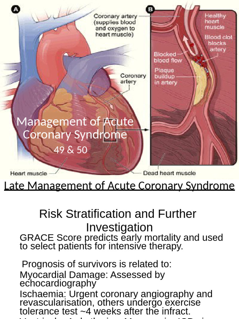 Acute Coronary Syndrome Management Guide | PDF