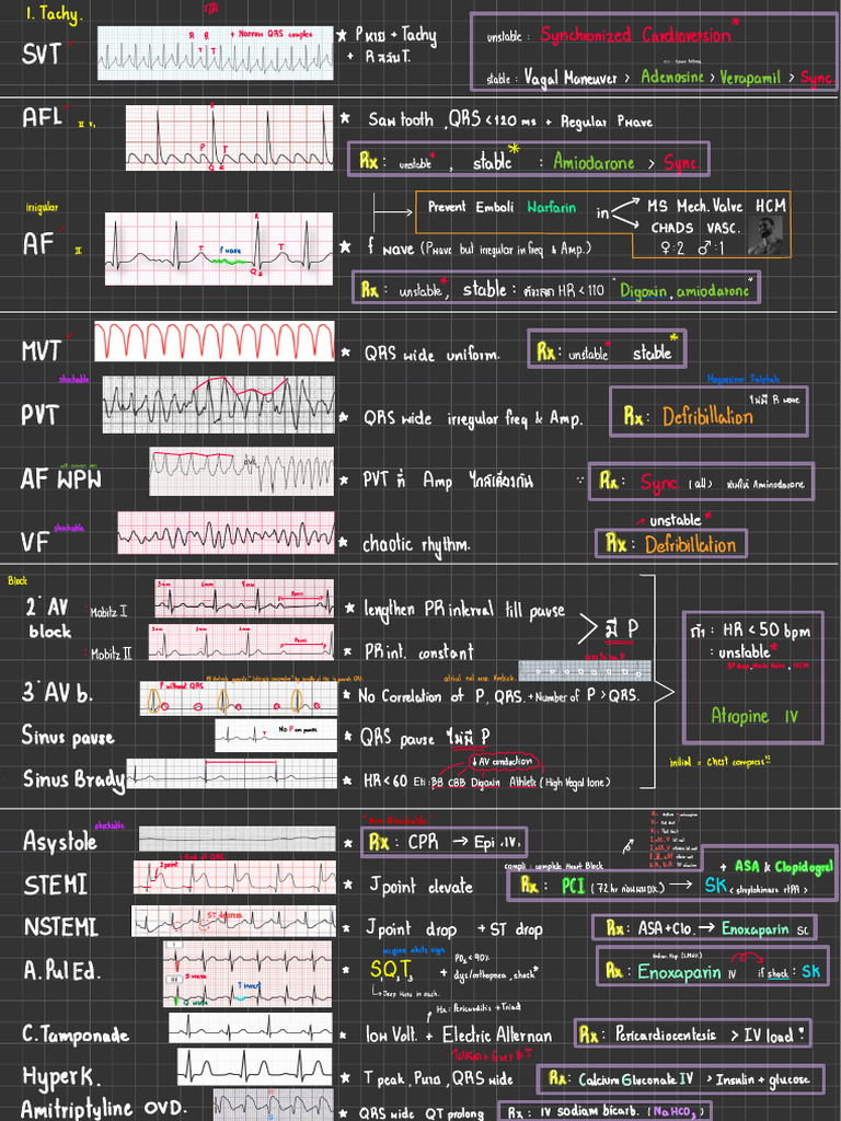 ECG | PDF