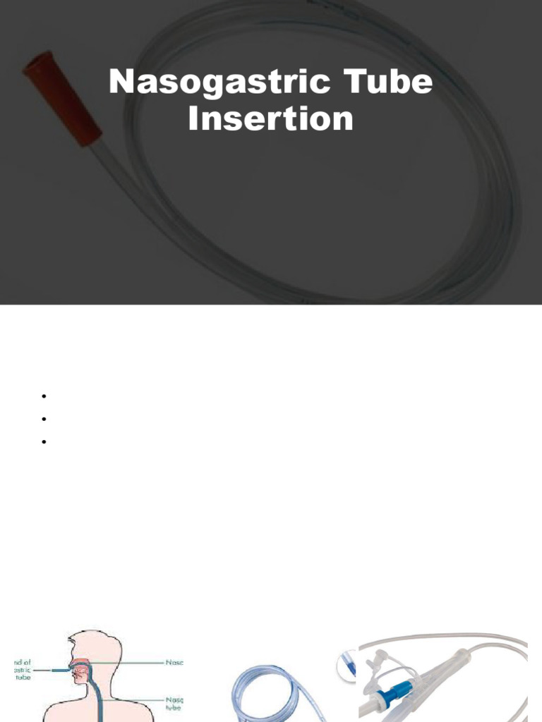 Nasogastric Tube Insertion Guide | PDF