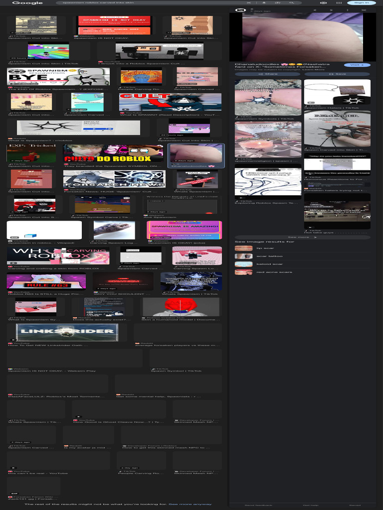 Spawnism Roblox Carved Into Skin - Google Search | PDF | Social Information  Processing | Social Networking Service