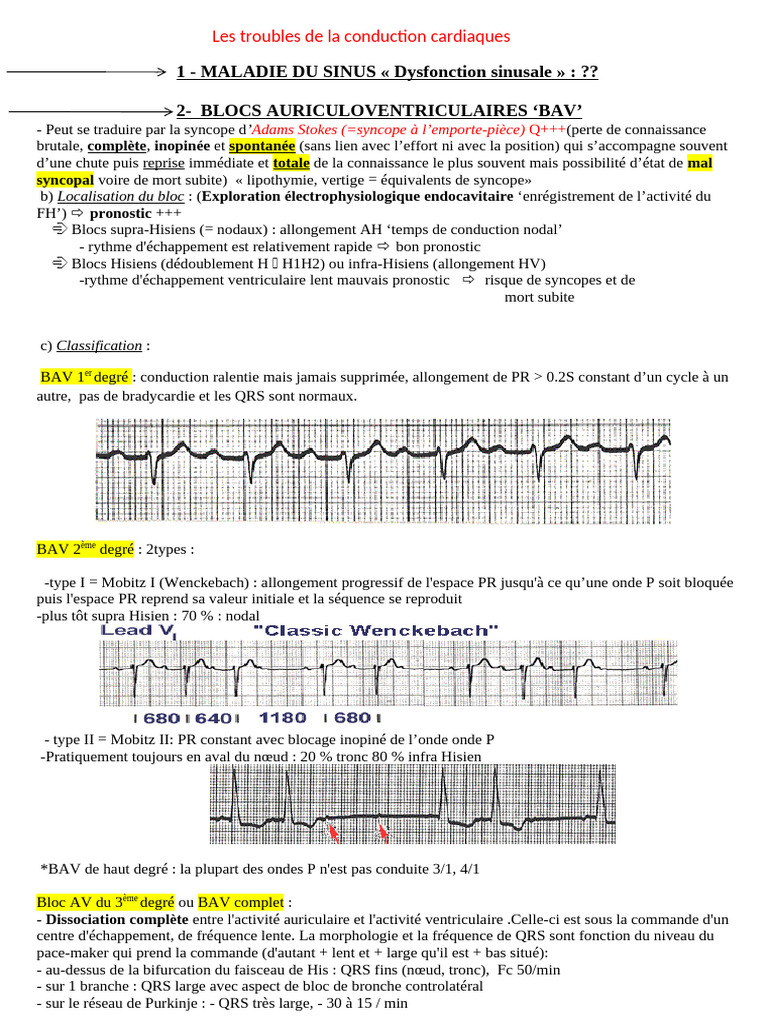 Troubles de la conduction cardiaque | PDF | Maladies cardiovasculaires ...