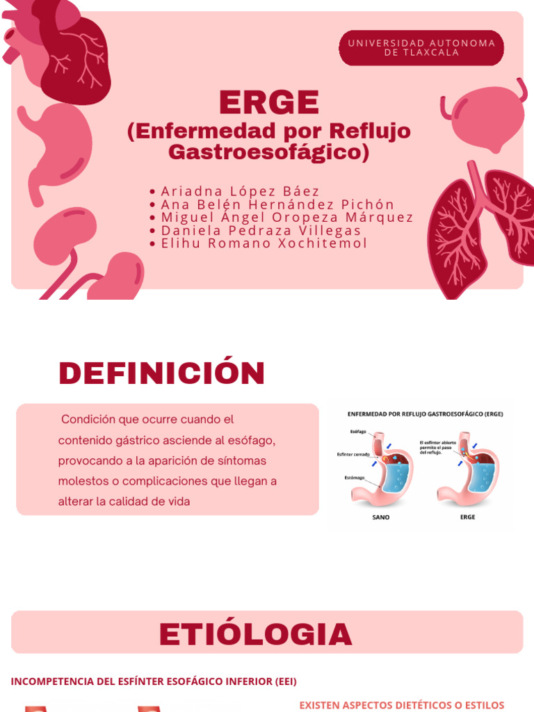 Guía Completa sobre ERGE y Tratamientos | PDF | La enfermedad por ...