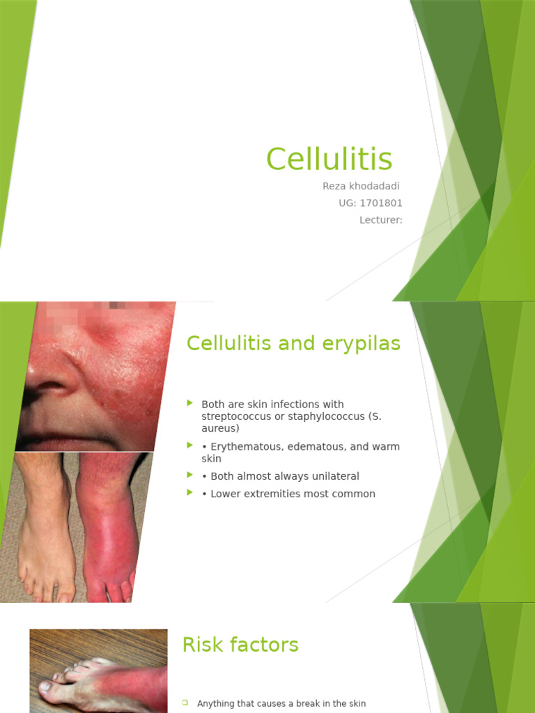 Erysipelas vs. Cellulitis Overview | PDF | Human Diseases And Disorders ...
