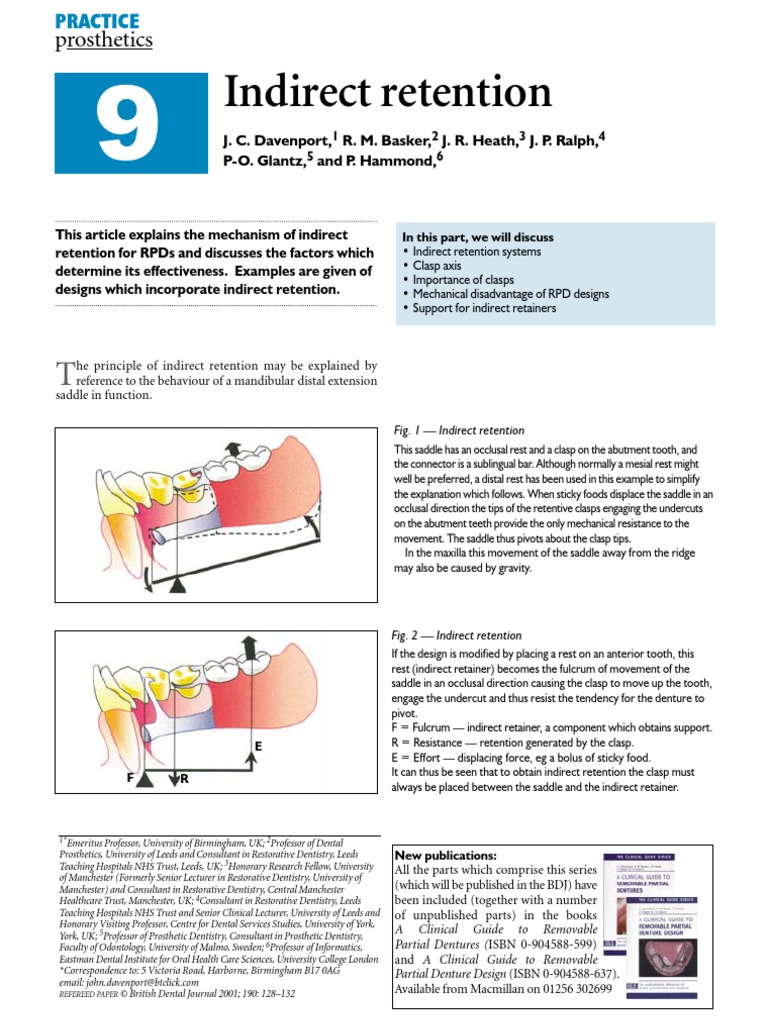 Indirect Retention Dentistry Dentures