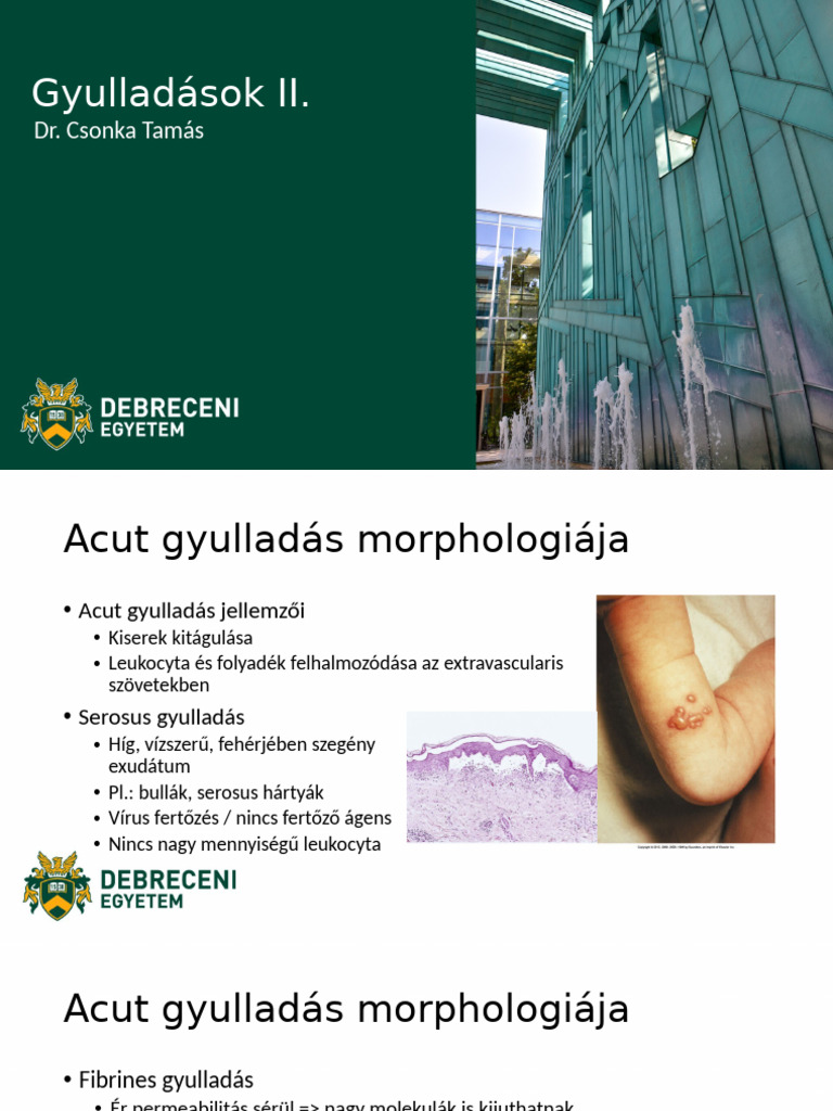 Hu 9 Gyulladás2 | PDF