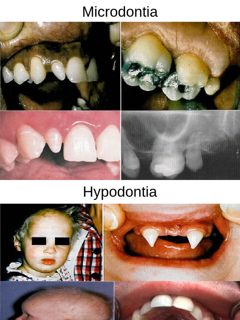 Dental Anomalies and Conditions Explained | PDF