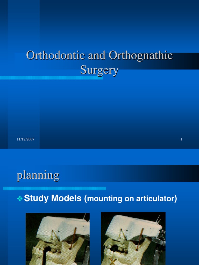 Orthognathic Surgery PDF
