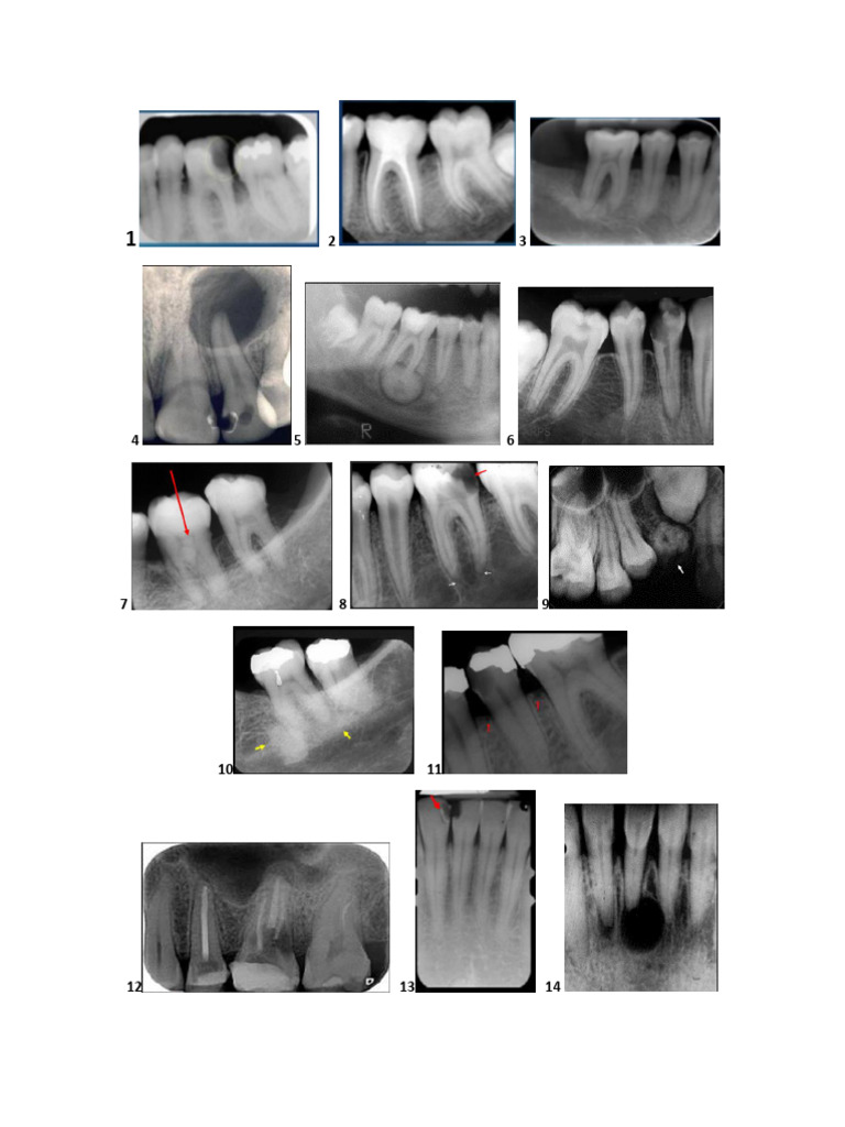 Imágenes Interpretaciones RX | PDF