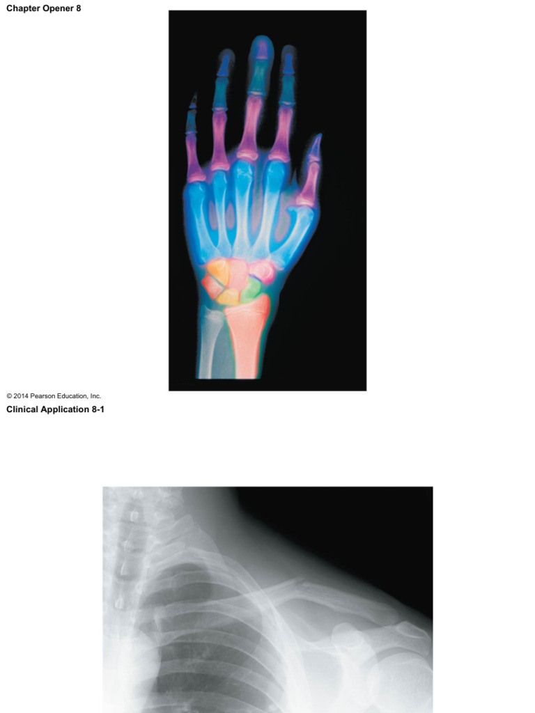 Unlabeled Bones of the Appendicular Skeleton | PDF | Arm | Elbow